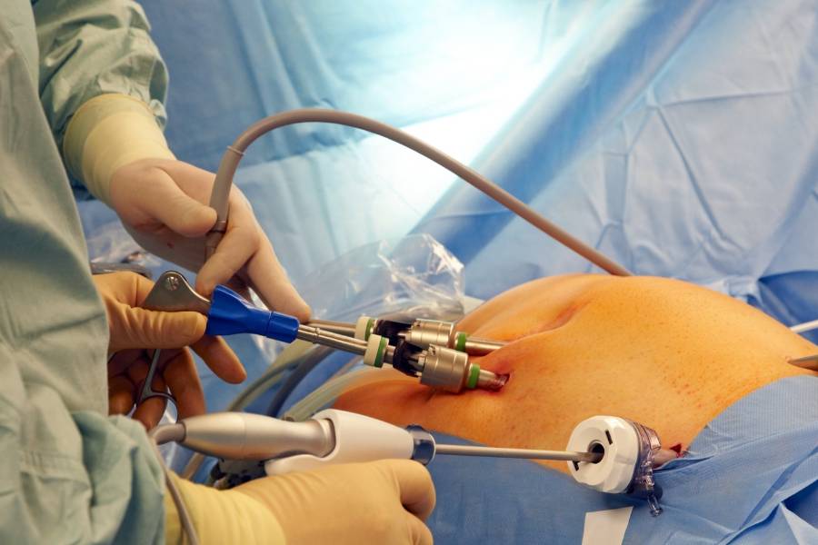 Laparoscopic Hernia Surgery 1