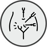 Laparoscopic Hernia Surgery