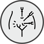 Pain After Hernia Surgery