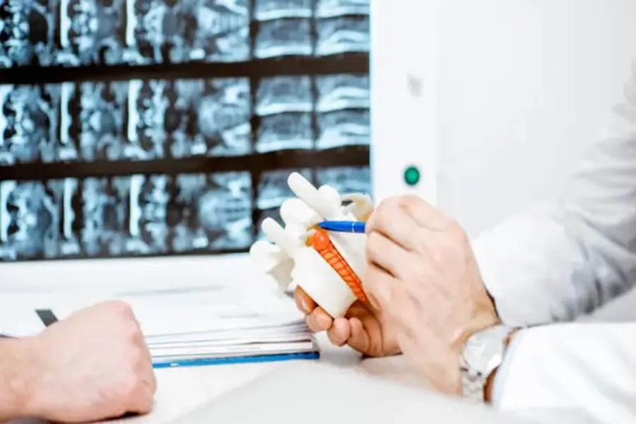 Why Hernias Recur Understanding and Avoiding Recurrence